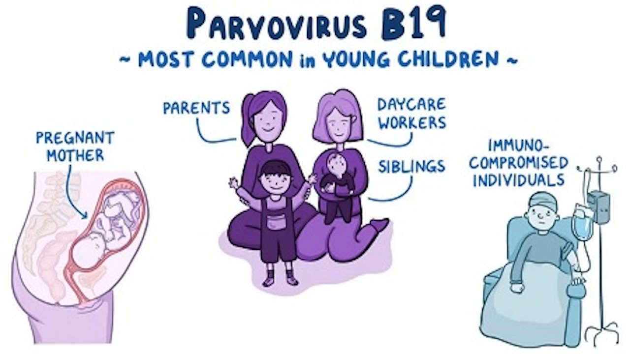 Parvovirüs B19