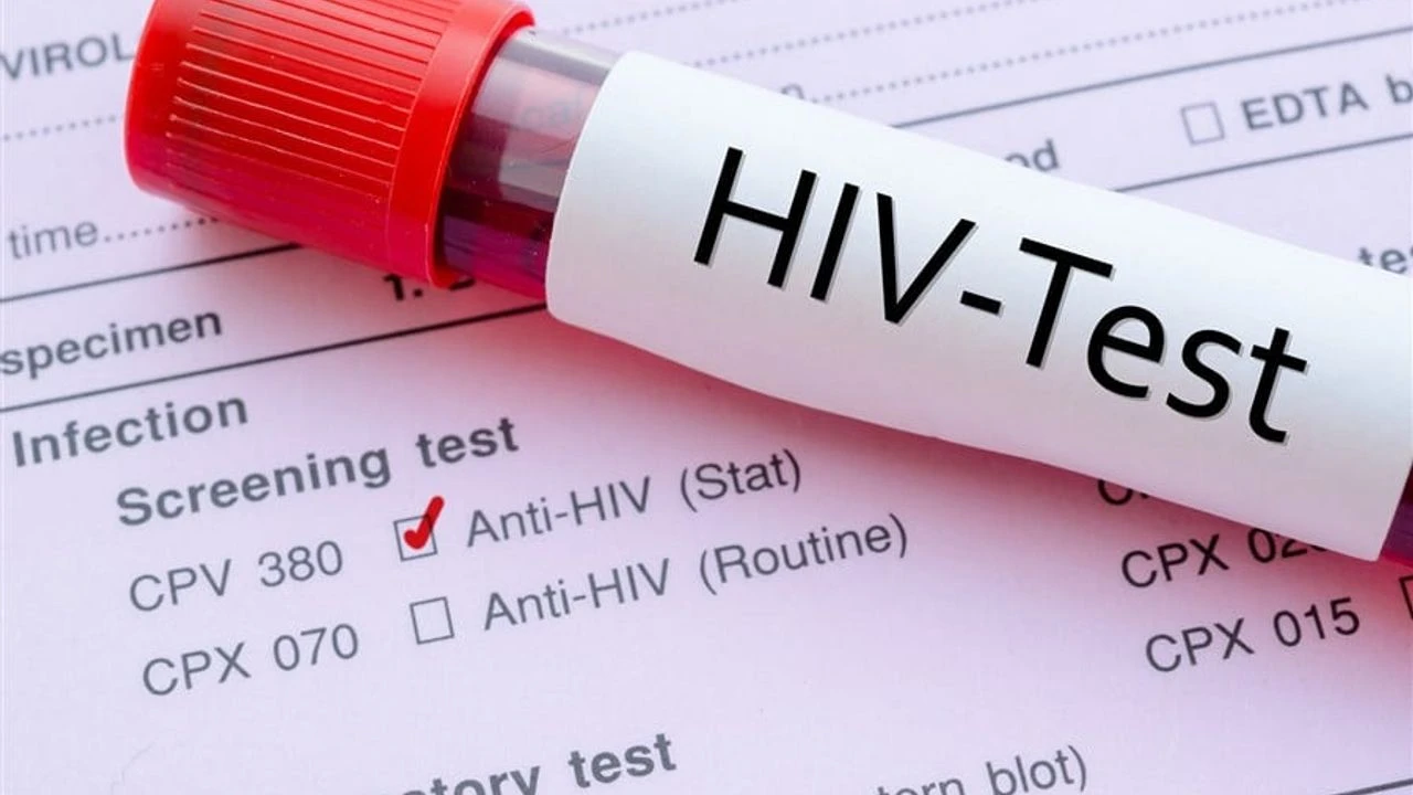 HIV