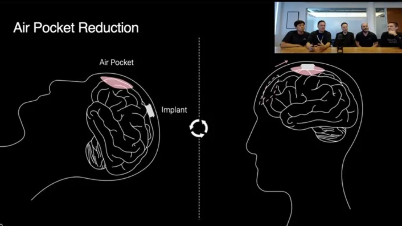 neuralink