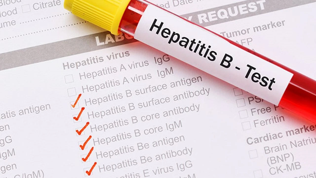 hepatit