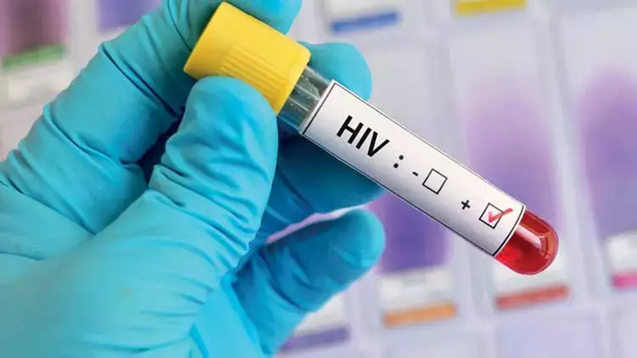 HIV